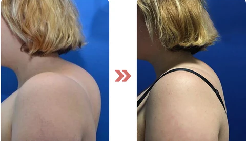 Histone Lymphatic MagneTherapy Germanium Earrings image Histone Lymphatic MagneTherapy Germanium Earrings