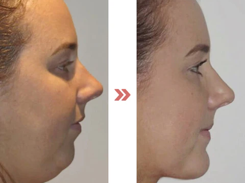 Histone Lymphatic MagneTherapy Germanium Earrings image Histone Lymphatic MagneTherapy Germanium Earrings