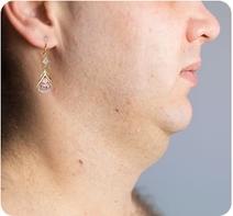 Histone Lymphatic MagneTherapy Germanium Earrings image Histone Lymphatic MagneTherapy Germanium Earrings