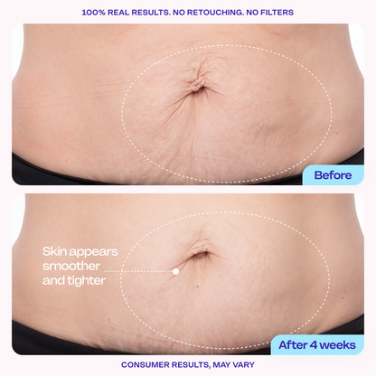 Final 3 hours 70% off 🔥 New!  Tighten & Smooth Belly Firming Cream